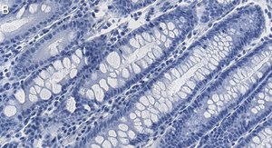 Anti-HCF-1 Antibody, clone 1B17 ZooMAb® Rabbit Monoclonal recombinant, expressed in HEK 293 cells