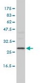 Monoclonal Anti-DEPC-1 antibody produced in mouse clone 2A5-4F5, purified immunoglobulin, buffered aqueous solution