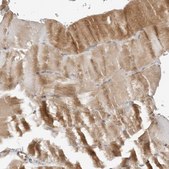 Anti-STXBP3 antibody produced in rabbit Prestige Antibodies® Powered by Atlas Antibodies, affinity isolated antibody, buffered aqueous glycerol solution