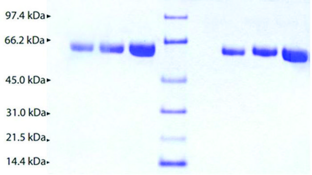 Alpha 2 Antiplasmin from human plasma &#8805;95% (SDS-PAGE)