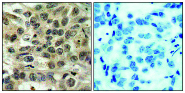 Anti-CDC25C antibody produced in rabbit affinity isolated antibody