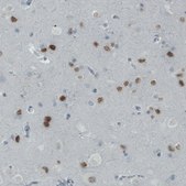 Monoclonal Anti-SATB2 antibody produced in mouse Prestige Antibodies® Powered by Atlas Antibodies, clone CL0323, purified immunoglobulin, buffered aqueous glycerol solution