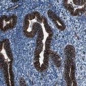 Anti-ZDHHC6 antibody produced in rabbit Prestige Antibodies® Powered by Atlas Antibodies, affinity isolated antibody, buffered aqueous glycerol solution