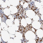 Anti-ALOX5AP antibody produced in rabbit Prestige Antibodies® Powered by Atlas Antibodies, affinity isolated antibody, buffered aqueous glycerol solution