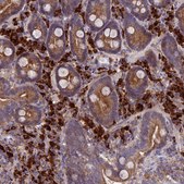 Anti-MIOS antibody produced in rabbit Prestige Antibodies® Powered by Atlas Antibodies, affinity isolated antibody, buffered aqueous glycerol solution