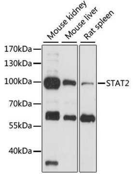 Anti-STAT2 antibody produced in rabbit