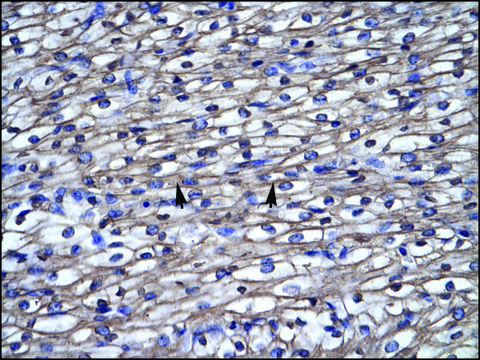 Anti-SEPT4 antibody produced in rabbit affinity isolated antibody