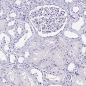 Anti-AKR1D1 antibody produced in rabbit Prestige Antibodies® Powered by Atlas Antibodies, affinity isolated antibody, buffered aqueous glycerol solution