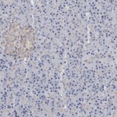 Anti-B3GNT3 antibody produced in rabbit Prestige Antibodies® Powered by Atlas Antibodies, affinity isolated antibody, buffered aqueous glycerol solution