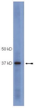 Anti-SOCS1 Antibody, clone 4H1 clone 4H1, Upstate&#174;, from mouse