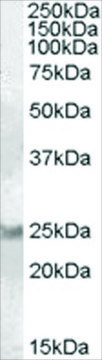 Anti-RAB8A antibody produced in goat affinity isolated antibody, buffered aqueous solution