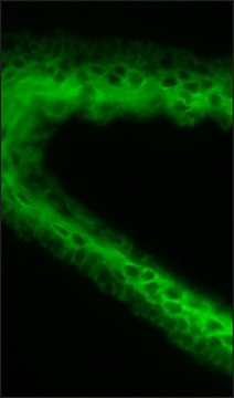 Anti-Cytokeratin pan antibody, Mouse monoclonal clone C-11, purified from hybridoma cell culture