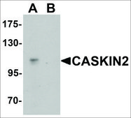 Anti-CASKIN2 antibody produced in rabbit affinity isolated antibody