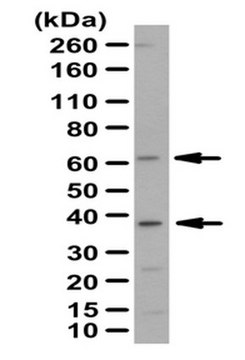 Anti-PANK2 Antibody from rabbit, purified by affinity chromatography