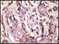 Anti-SUMO4 (M55 Wild type) antibody produced in rabbit saturated ammonium sulfate (SAS) precipitated, buffered aqueous solution