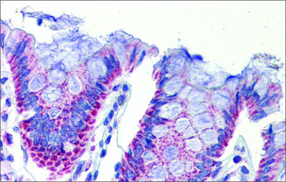 Anti-IMPDH1 antibody produced in rabbit affinity isolated antibody