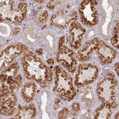 Anti-ARSB antibody produced in rabbit Prestige Antibodies® Powered by Atlas Antibodies, affinity isolated antibody, buffered aqueous glycerol solution