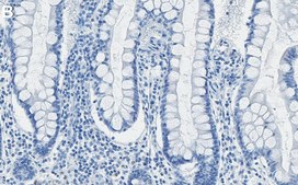 Anti-RIP1/RIPK1 Antibody, clone 1N16 ZooMAb® Rabbit Monoclonal recombinant, expressed in HEK 293 cells