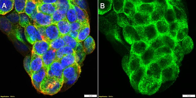 Anti-SLC31A1/CTR1 Antibody, clone 1K21 ZooMAb&#174; Rabbit Monoclonal recombinant, expressed in HEK 293 cells