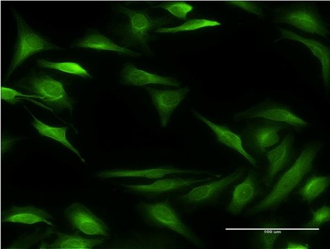 Monoclonal Anti-ALOX15B antibody produced in mouse clone 4A7, purified immunoglobulin, buffered aqueous solution