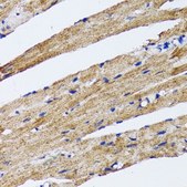 Anti-LC3B antibody produced in rabbit