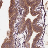 Anti-PLXNB1 antibody produced in rabbit Prestige Antibodies® Powered by Atlas Antibodies, affinity isolated antibody, buffered aqueous glycerol solution