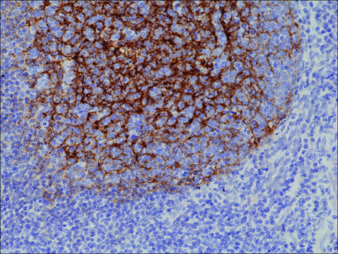 Anti-CD21 antibody, Rabbit monoclonal recombinant, expressed in HEK 293 cells, clone RM372, purified immunoglobulin