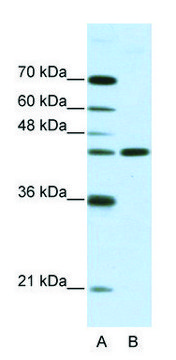 Anti-NMUR2 (N-terminal) antibody produced in rabbit affinity isolated antibody