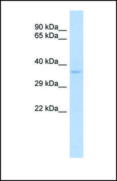 Anti-TRADD antibody produced in rabbit affinity isolated antibody