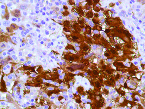 Anti-Calretinin antibody, Rabbit monoclonal recombinant, expressed in proprietary host, clone SP13, tissue culture supernatant