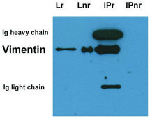 Monoclonal Anti-Vimentin antibody produced in mouse clone VI-01