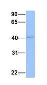 Anti-ZBTB32 antibody produced in rabbit affinity isolated antibody