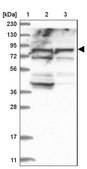 Anti-ACOX3 antibody produced in rabbit Prestige Antibodies® Powered by Atlas Antibodies, affinity isolated antibody, buffered aqueous glycerol solution