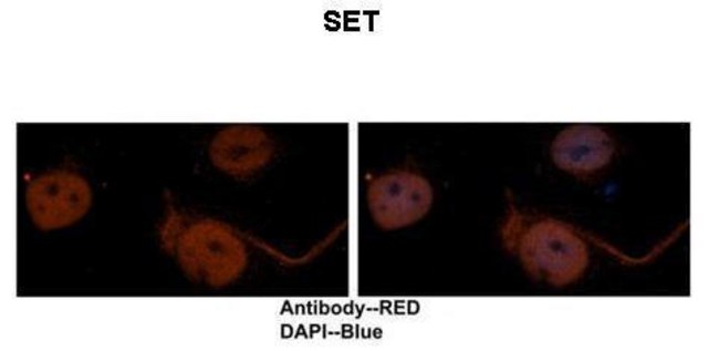 Anti-SET, (N-terminal) antibody produced in rabbit affinity isolated antibody