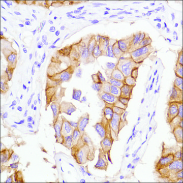 Anti-EGFR antibody, Rabbit monoclonal clone SP125, recombinant, expressed in proprietary host, affinity isolated antibody