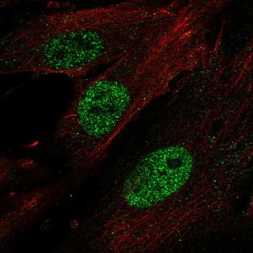 Anti-HOXA11 antibody produced in rabbit Prestige Antibodies&#174; Powered by Atlas Antibodies, affinity isolated antibody