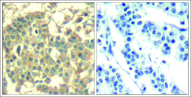 Anti-MET (Ab-1003) antibody produced in rabbit affinity isolated antibody