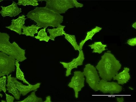 Anti-MPP5 antibody produced in rabbit purified immunoglobulin, buffered aqueous solution