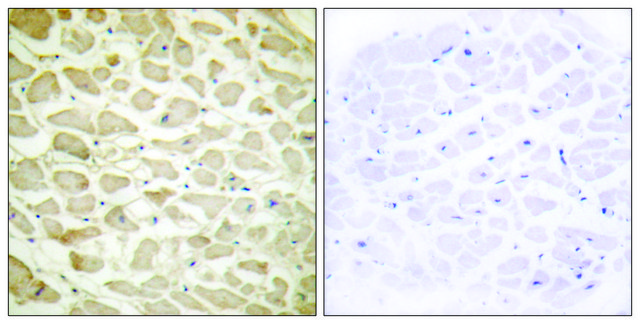 Anti-Collagen XIV &#945;1, N-Terminal antibody produced in rabbit affinity isolated antibody