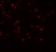 Anti-APC13 antibody produced in rabbit affinity isolated antibody, buffered aqueous solution