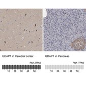 Anti-GDAP1 antibody produced in rabbit Prestige Antibodies® Powered by Atlas Antibodies, affinity isolated antibody, buffered aqueous glycerol solution