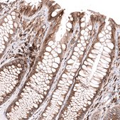 Monoclonal Anti-Ifi27 Antibody Produced In Mouse Prestige Antibodies® Powered by Atlas Antibodies, clone CL14627, affinity isolated antibody, buffered aqueous glycerol solution