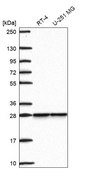Anti-SNRPB2 antibody produced in rabbit Prestige Antibodies® Powered by Atlas Antibodies, affinity isolated antibody