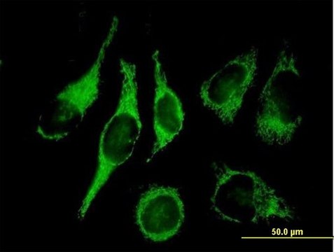 Anti-HSD17B10 antibody produced in mouse purified immunoglobulin, buffered aqueous solution