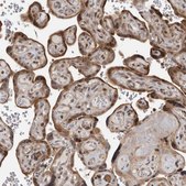 Anti-RABIF antibody produced in rabbit Prestige Antibodies® Powered by Atlas Antibodies, affinity isolated antibody, buffered aqueous glycerol solution