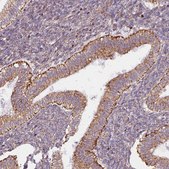 Anti-MAGT1 antibody produced in rabbit Prestige Antibodies® Powered by Atlas Antibodies, affinity isolated antibody, buffered aqueous glycerol solution