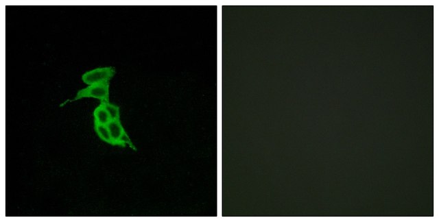 Anti-GPR143 antibody produced in rabbit affinity isolated antibody