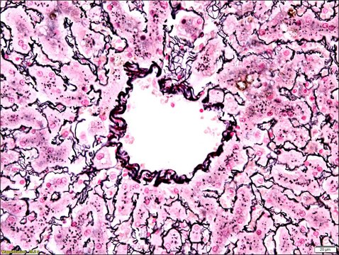 Reticulum Stain Kit