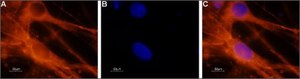 Anti-Sodium Channel PN4 antibody produced in rabbit affinity isolated antibody, lyophilized powder