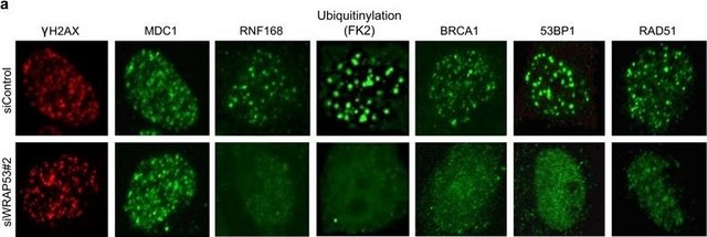 抗 RNF168 抗体 from rabbit, purified by affinity chromatography